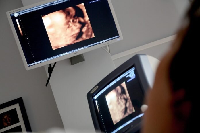 Pesquisa reforça técnica fetal para hérnia diafragmática