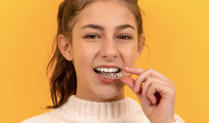 Alinhador invisível: como funciona o tratamento dentário